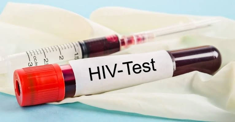 HIV చికిత్సలో విప్లవం: యాంటీరెట్రోవైరల్ థెరపీ, U=U శక్తి, పూర్తి వివరణ